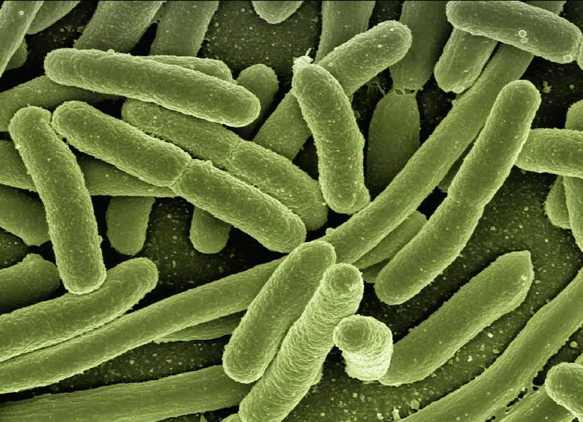 Microscopic view of Vibrio vulnificus bacteria in warm seawater
